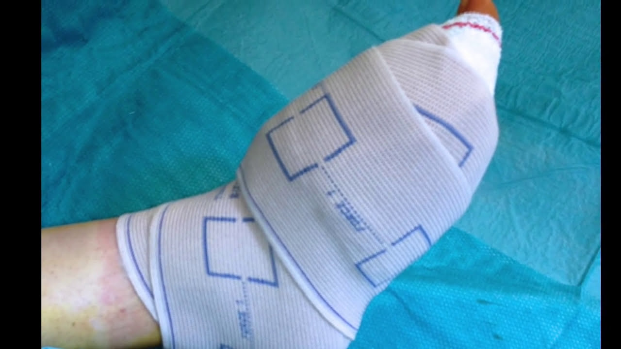 Rééducation des petits orteils après chirurgie