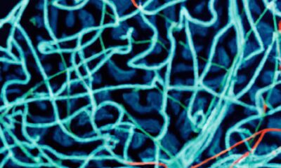 secousse-hypnique-causes-et-symptomes-expliques